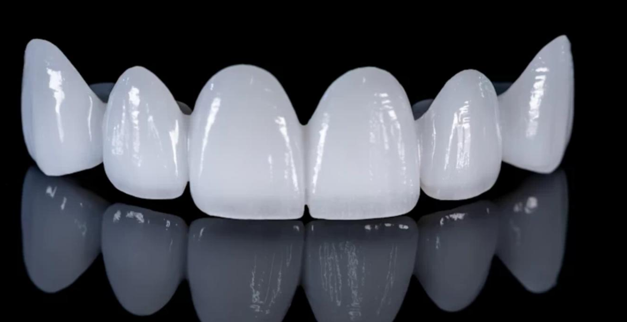 Celebrities Secret Snap-On Veneers Set